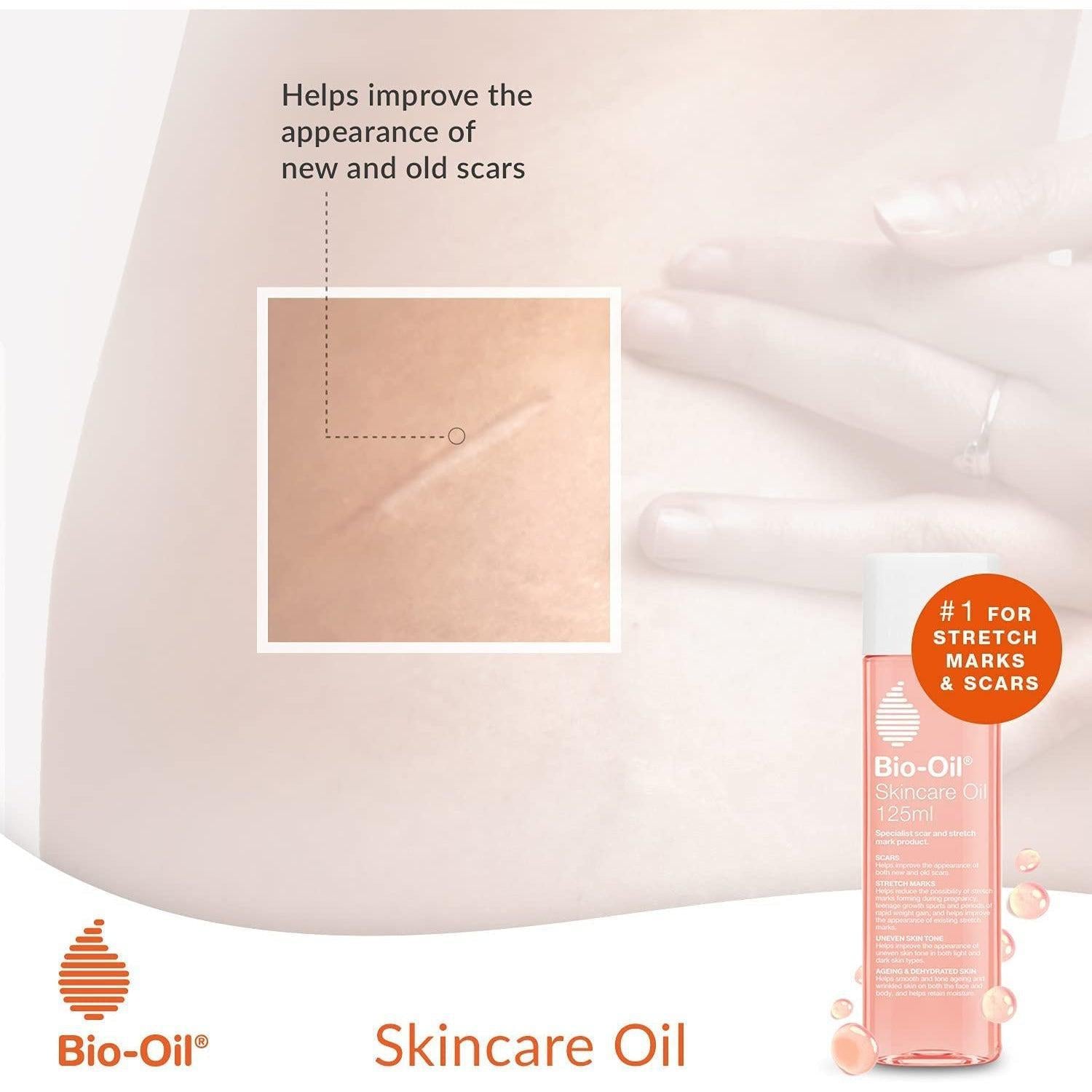 Bio-Oil Skincare Oil 200ml - Improve the Appearance of Scars, Stretch Marks and Skin Tone ,200 ml