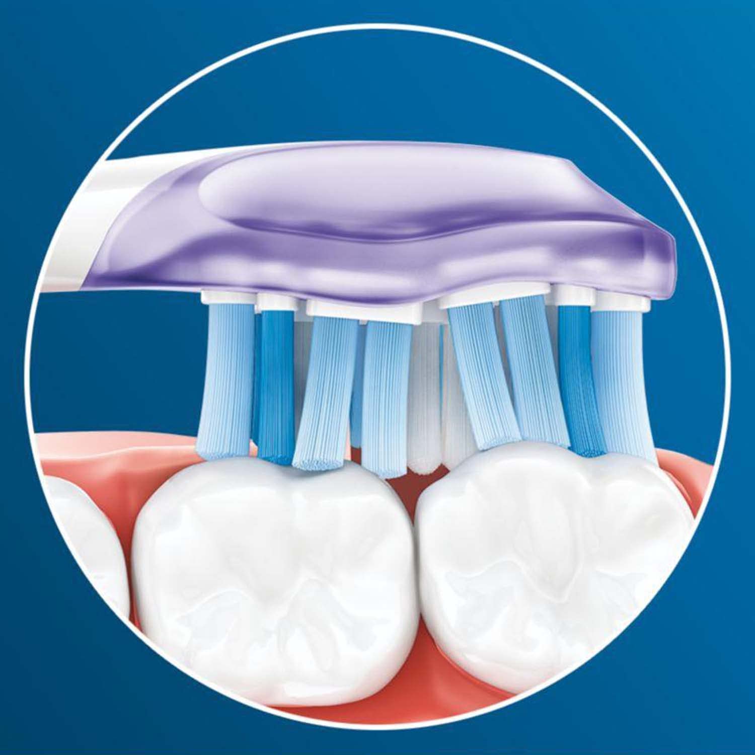 Philips Sonicare HX9054/17 Premium Gum Care White BrushSync Heads (Compatible with All Philips Sonicare Handles), Pack of 4