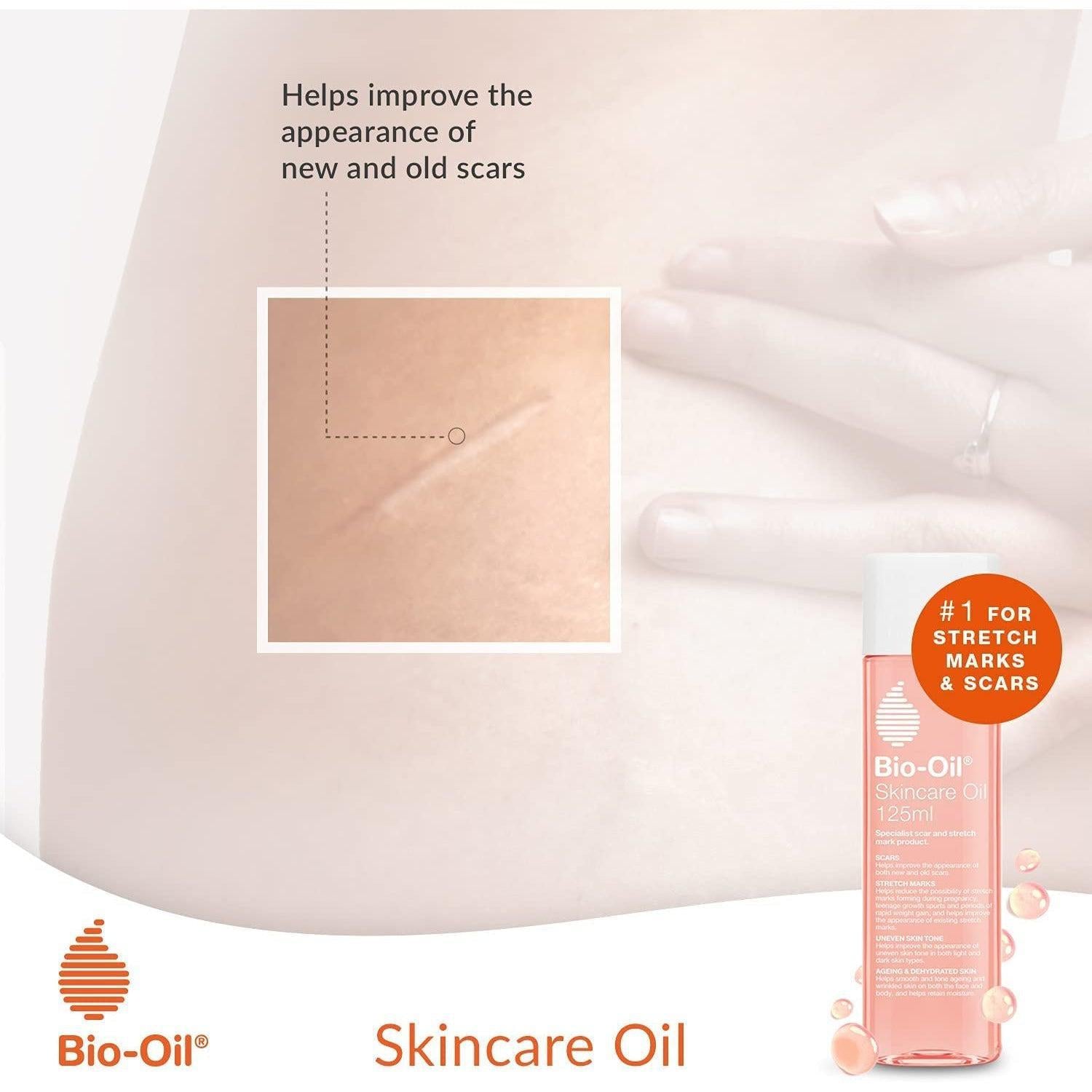 Bio-Oil Skincare Oil - Improve the Appearance of Scars, Stretch Marks and Skin Tone ,60ml - Healthxpress.ie