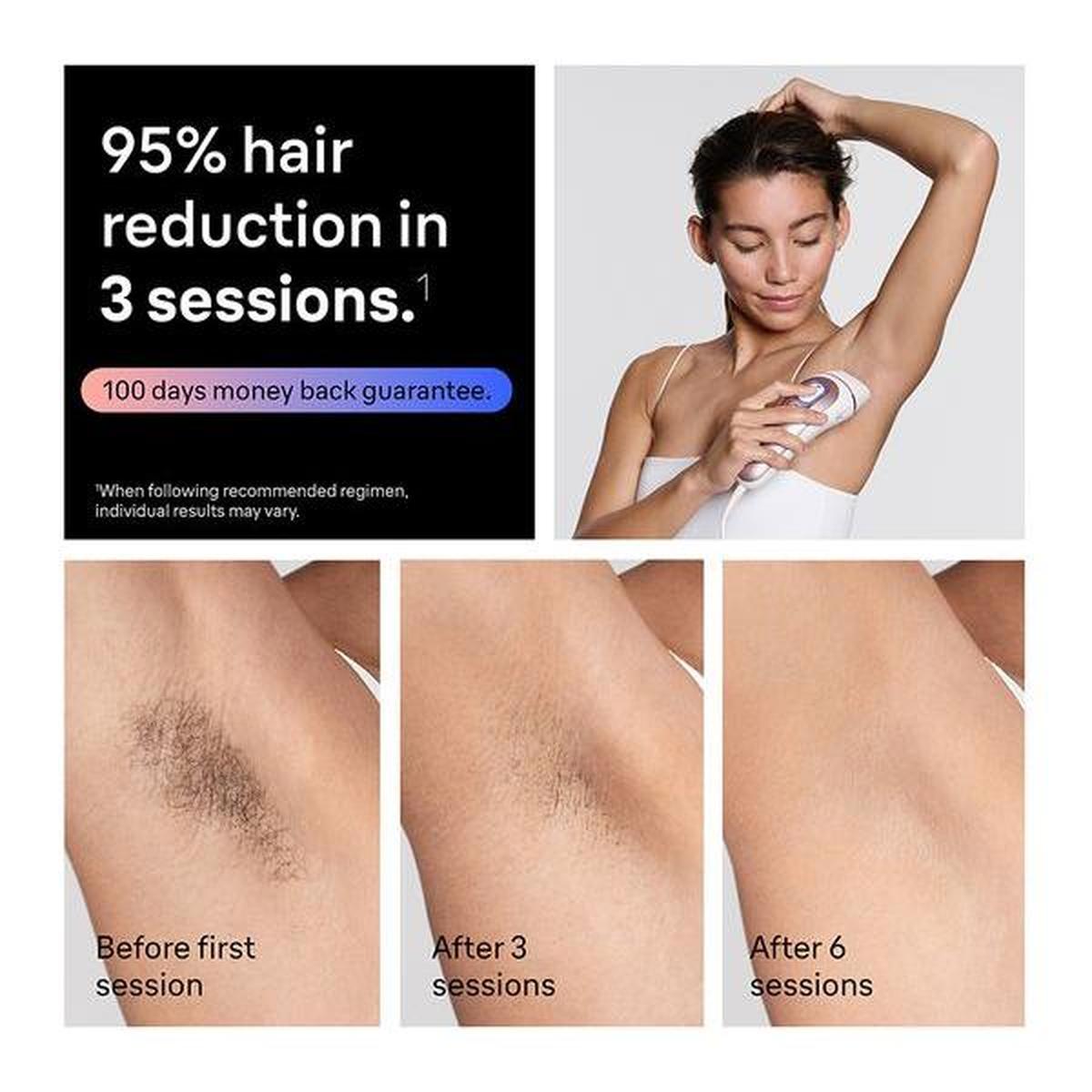 Braun Skin i-expert IPL device showing underarm hair reduction results over three and six sessions in a white, ergonomic design.
