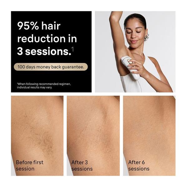 BRAUN Silk-expert Pro 5 PL5441 IPL Hair Removal System - White